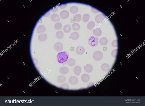 Human Blood Smear Showing Plasmodium Vivax Stock Photo (Edit Now) 491714728