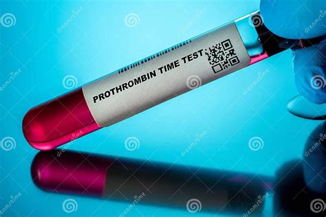 Image result for Prothrombin Time Normal Result