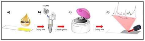 Biosensors | Special Issue : Biosensors for Body Fluid Analysis