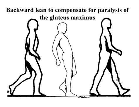 Image result for Contralateral Gait