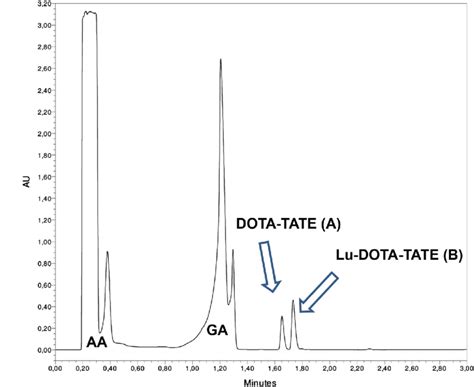 Image result for DOTA-TATE Scan