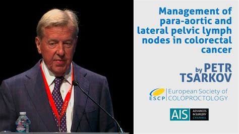 AIS Channel · Management of para-aortic and lateral pelvic lymph nodes in colorectal cancer