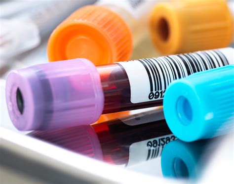 Hemoglobin electrophoresis