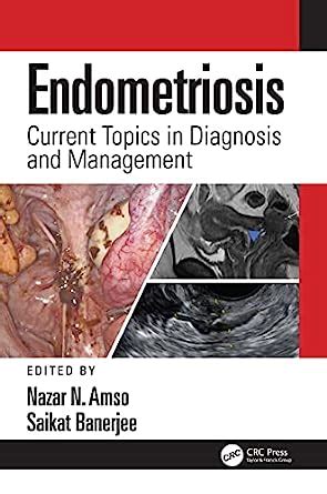 Endometriosis: Current Topics in Diagnosis and Management eBook : Amso ...