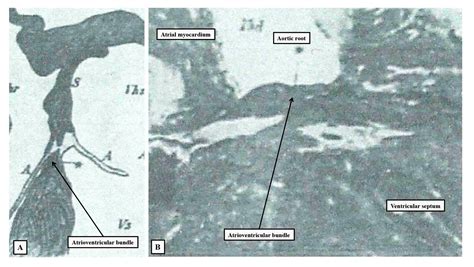 The Atrioventricular Conduction Axis Revisited for the 21st Century