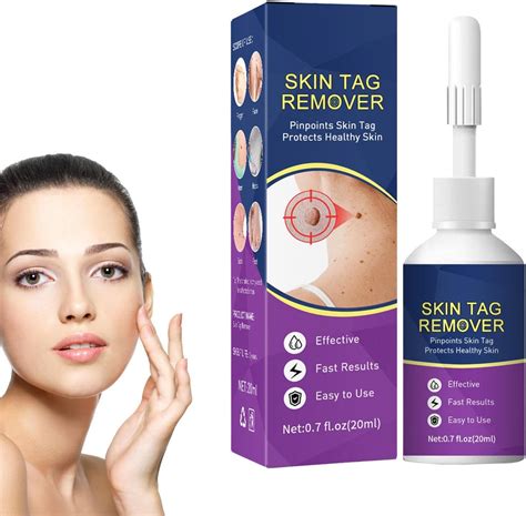 Verrugas Verrugas Nitrógeno Líquido, Rápido Y Fácil Eficaz Salud ...