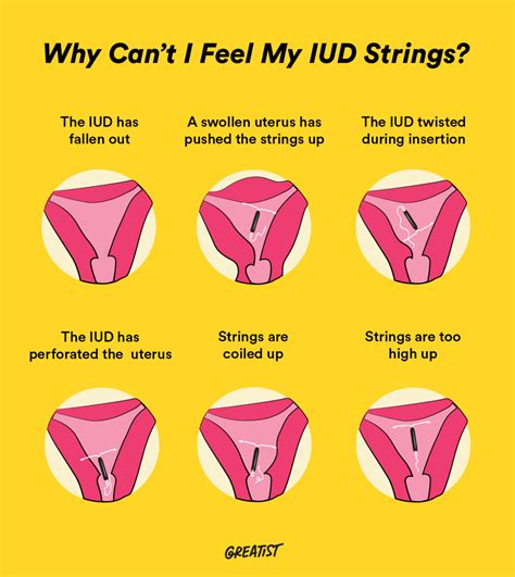 Can’t Feel IUD String? Why It Happens and What to Do