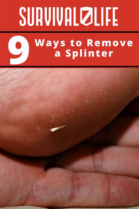 Image result for Infected Splinter Removal