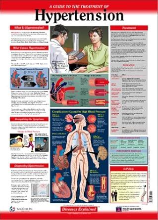 Diseases Explained: Hypertension Wall Chart : Lexi-Comp: Amazon.in: Books