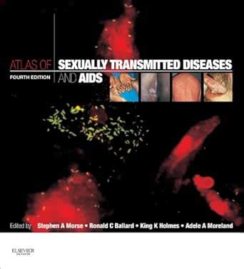 Atlas of Sexually Transmitted Diseases and AIDS: Expert Consult eBook ...