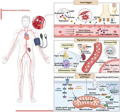 Translational Barriers and Optimization Strategies for Remote Ischemic ...
