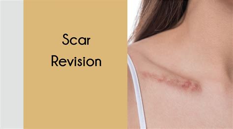 Scar Revision Procedure 的图像结果