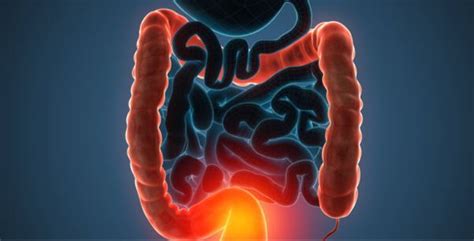 Filgotinib effective in managing active ulcerative colitis: The Lancet
