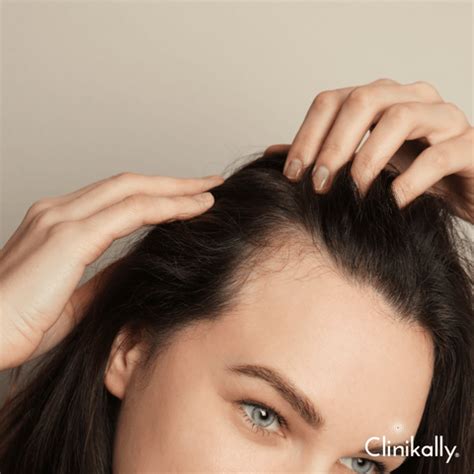 Procapil vs. Redensyl for Hair Fall (Doctor's Guide) | Clinikally
