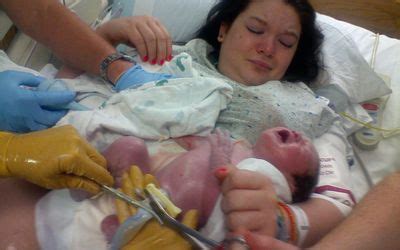 Bildergebnis für umbilical cord around neck complications