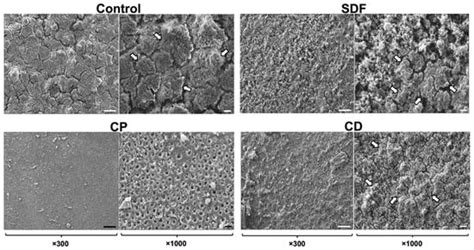 Effects of Tooth Desensitizers on Streptococcus mutans Biofilm ...