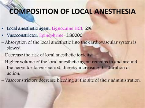 Composition of Local Anesthesia 的图像结果