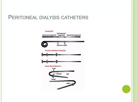 Peritoneal dialysis catheter | PPTX