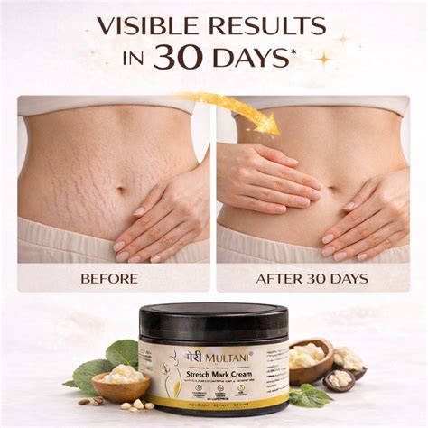Merimultani Stretch Mark Cream – MeriMultani