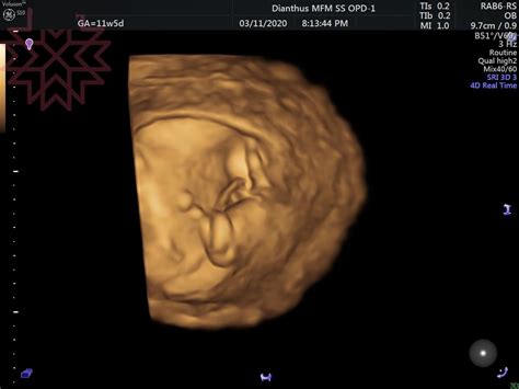 【pregnancy】懷孕前三個月症狀、胎兒成長歷程-媽咪兒板｜PopDaily 波波黛莉