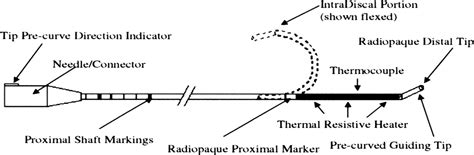 Image result for Idet Disc Procedure