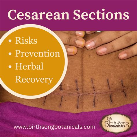 Cesarean Sections: Risks, Prevention, and Herbs for Recovery– Birth ...