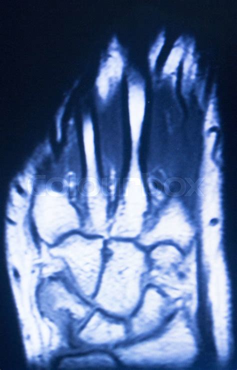 Image result for High-Resolution Hand MRI