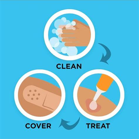BAND-AID Adhesive Bandages for Minor Cuts and Scrapes Featuring Junior ...