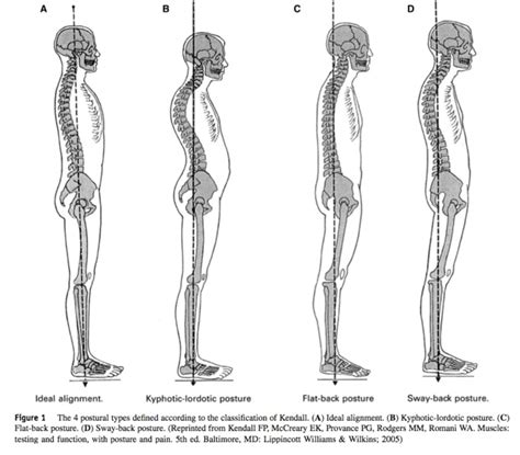 Image result for Normal Posture