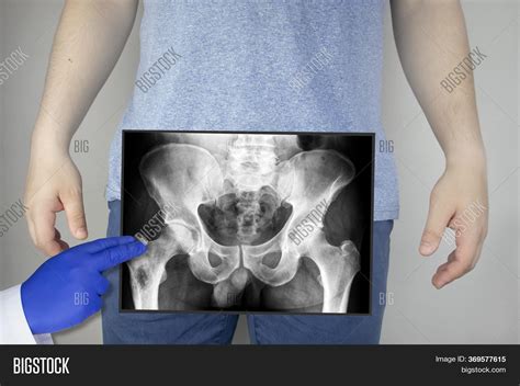 X-ray Pelvic Bones Man Image & Photo (Free Trial) | Bigstock