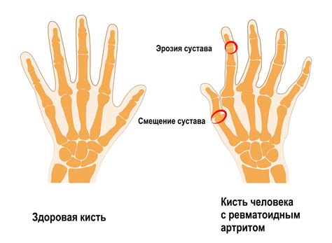 Как сделать чтобы не болел палец на руке