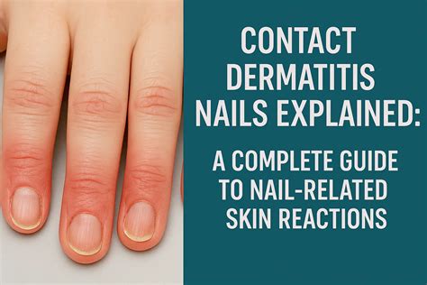 Contact Dermatitis Nails Explained: Complete 2025 Guide