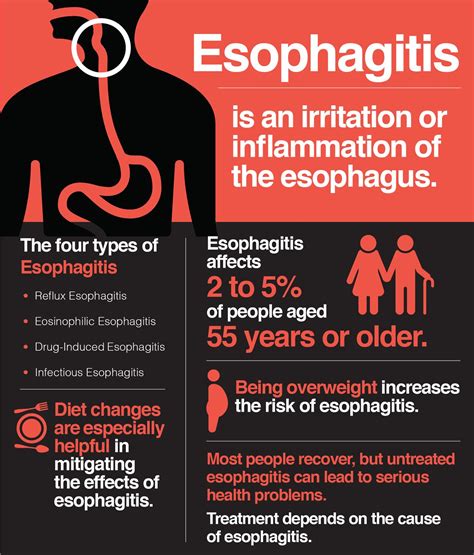 Esophagus Pain Symptoms