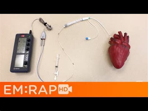 The Differences Between External and Implantable Pacemakers