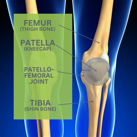 Runner's Knee Explained at Eileen Porras blog
