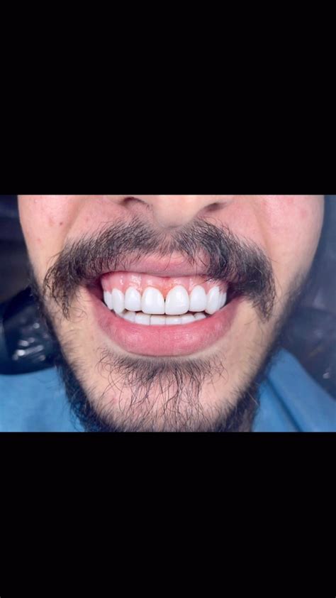 ‎الحارثية_شارع_الكندي‎ (@dr.ali_smile) • Instagram photos and videos