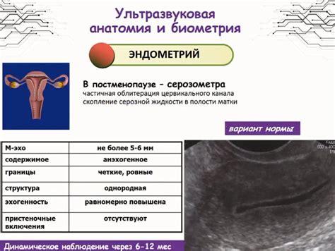 Ультразвуковая диагностика в гинекологии в соответствии с клиническими ...
