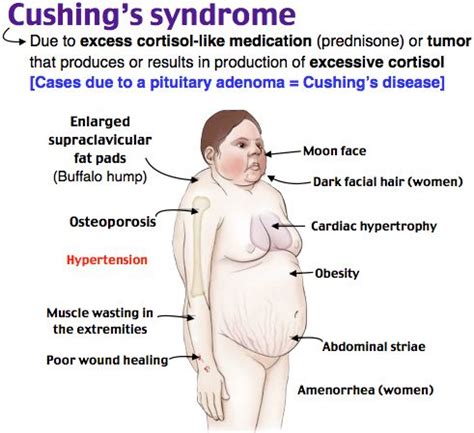 Image result for Cachexia Test