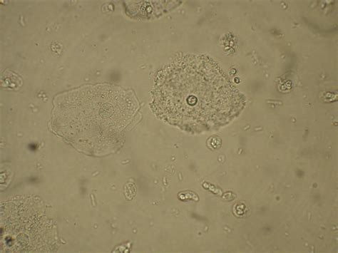 Provider-Performed Microscopy Procedures - Physician Assistant Clinics