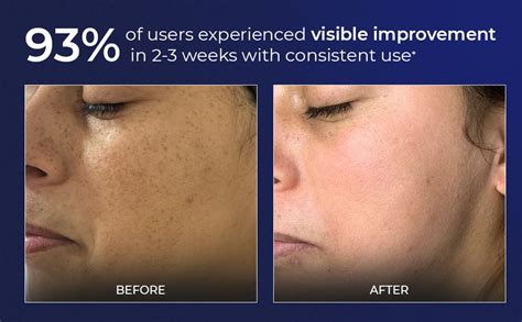 Brightening Face Cleanser for Dull & Uneven Skin | Aqueria