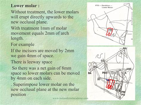 Image result for Vto Core Target