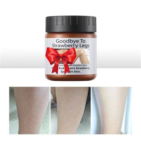 Strawberry Legs Treatment Cream MZF22 For Women Keratosis Pilaris ...