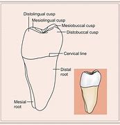 Image result for mesial