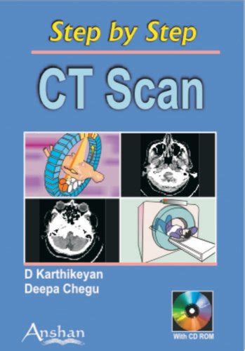 Buy CT Scan (Step by Step) Book Online at Low Prices in India | CT Scan ...