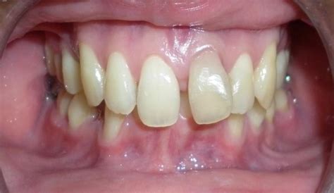 Smile Arc Treatments available in smile arc dental vijayawada