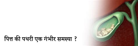 पित्त की पथरी एक गंभीर समस्या | Gallstones in Hindi