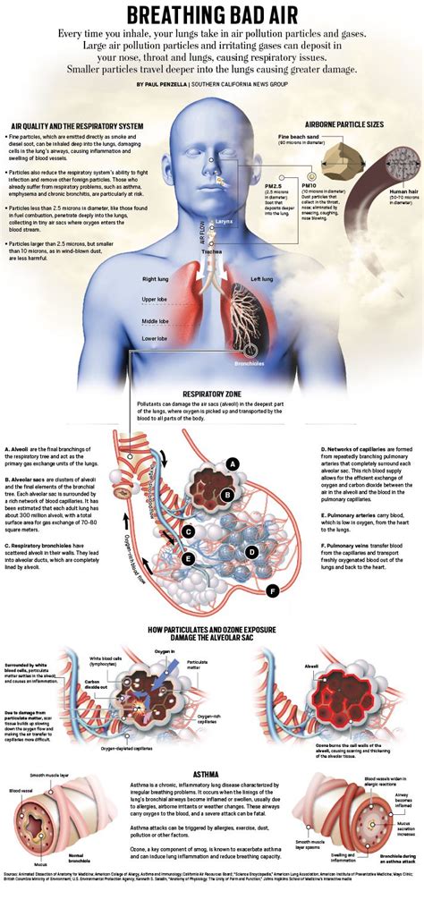 Image result for Particulates Health Effects