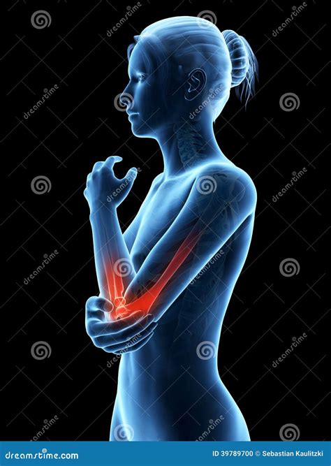 Pain In Left Arm Elbow Joint at Gladys Kestner blog