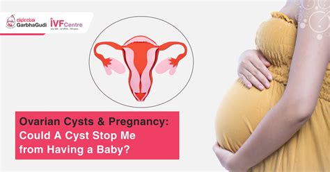Ovarian Cysts and Pregnancy: What You Need to Know