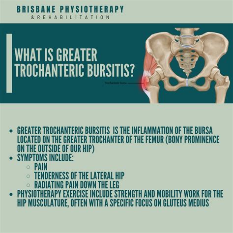 What Is Greater Trochanteric Bursitis? | Brisbane Physiotherapy & Podiatry posted on the topic ...